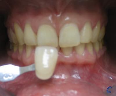 Bogeblancaprs sd79qh - Eugenol