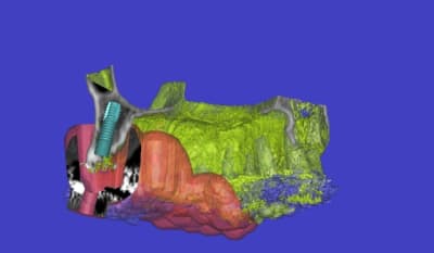 Bordas monique 3d1 ae4hju - Eugenol