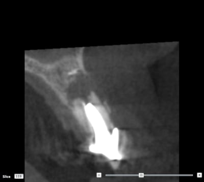 Bourdon scan avant ejcfy6 - Eugenol