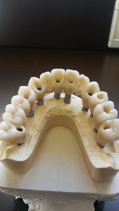 Bridge5 ir6e3t - Eugenol