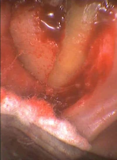 Cab1 cwpixo - Eugenol