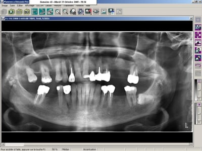 Calcul fvx5hi - Eugenol