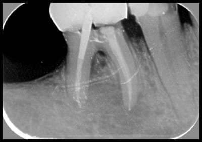 Canoplein mh4eib - Eugenol