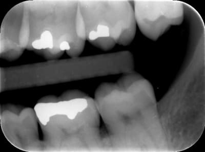 Capteur 01 - Eugenol