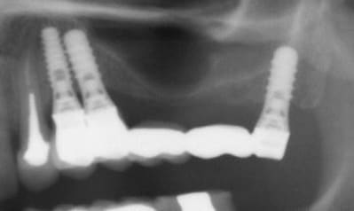 Capture pano ialrgc - Eugenol