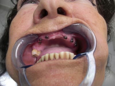 Carpinelipilier ns8xfr - Eugenol