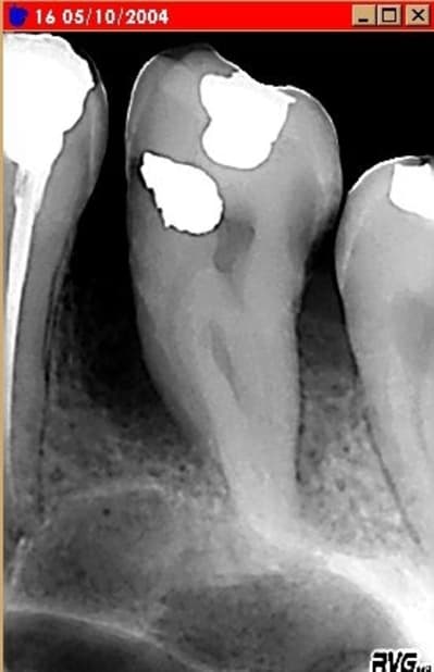 Cas 2 bsz1fx - Eugenol