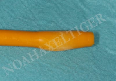 Catheter modifi  et d gonfl  oepulv - Eugenol