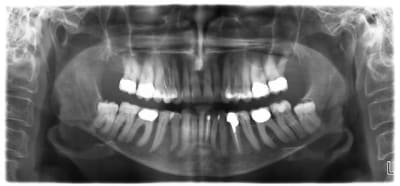 Cbct1 zg8tkg - Eugenol