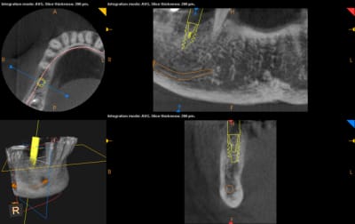 Cbct amt mxcpxj - Eugenol