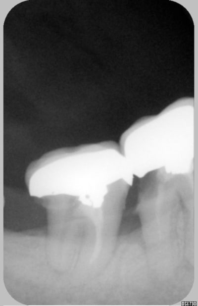 Ccm3 znid2w - Eugenol