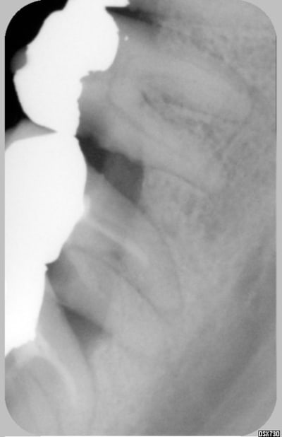 Ccm slkwd7 - Eugenol