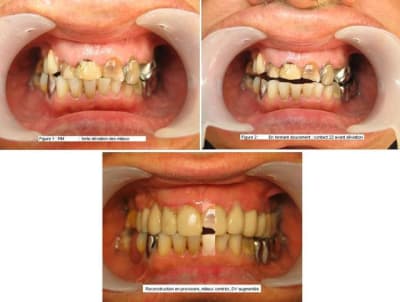 Centrage des milieux 2 k3cp8r - Eugenol