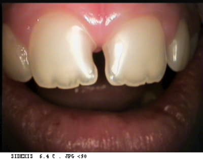 Centrales tkzcp7 - Eugenol