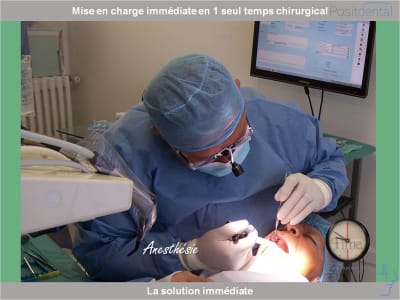 Chirurgie guidée mise en charge immédiate 0002 othz79 - Eugenol