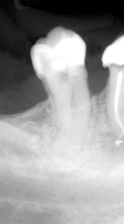 Civ sur 47 c5pvdw - Eugenol