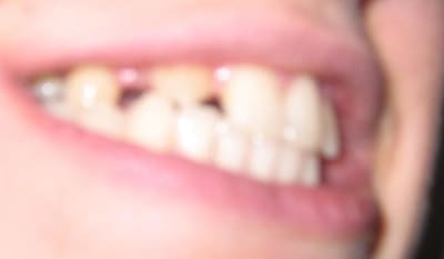 Close yujrc3 - Eugenol