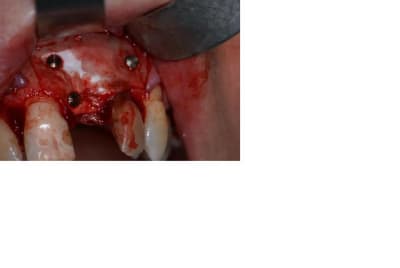Clou ustomed wroezz - Eugenol