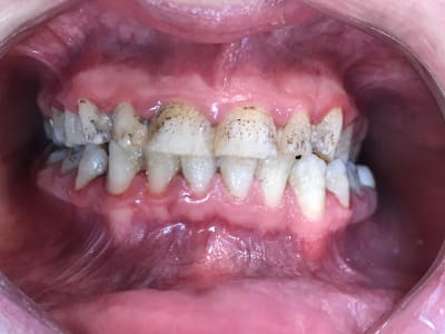 Cmzmqueklqcbheh3dtpy - Eugenol