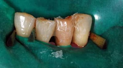 Collage01 i31gtx - Eugenol