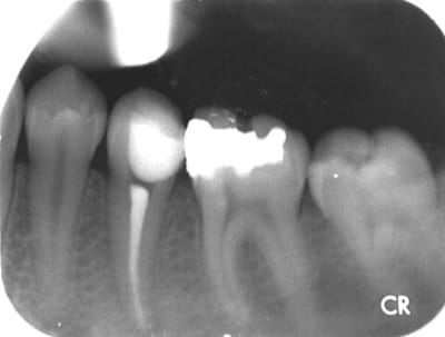 Compo   sc33 2 oszue7 - Eugenol