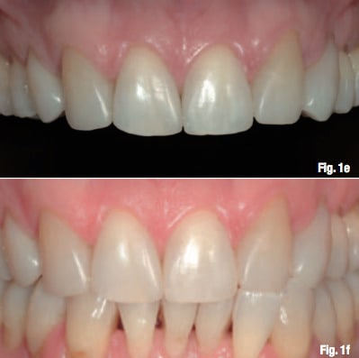 Compo apr s bv2mfy - Eugenol