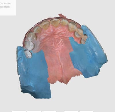 Copie avec alginate ywkejf - Eugenol