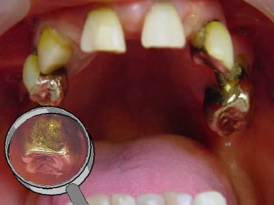 Corrosion g2hu0d - Eugenol