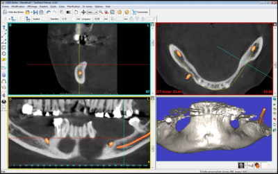 Coupe secteur 3 akuiru - Eugenol