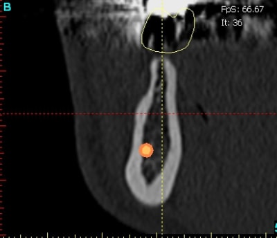 Cri ver cross section dkyqso - Eugenol