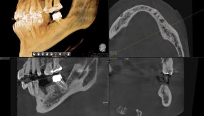 Ct2ywmkudp3a1w0ra0vu2qpnjbeu - Eugenol