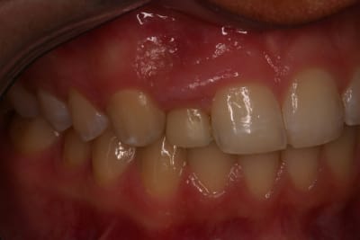 Ct4iov9ujiekgsix8pylq60ozpo7 - Eugenol