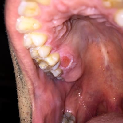 Cueat5v0gviowcshoou8 - Eugenol