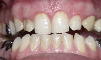 Début1 klscjz - Eugenol