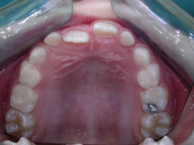 D but  3  h3yk62 - Eugenol