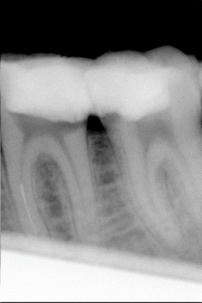 D qqhpm9 - Eugenol