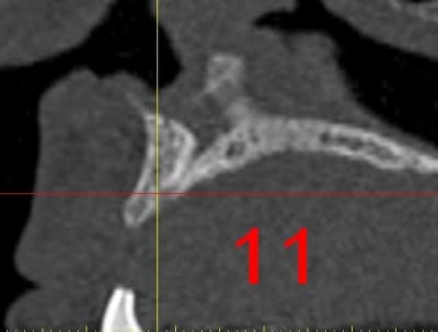 Dar11 xlk5pq - Eugenol