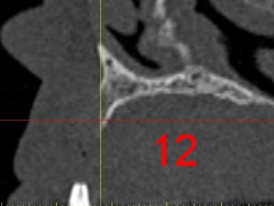 Dar12 fcbpom - Eugenol