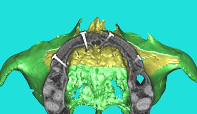 Dar 3d xkb3uv - Eugenol