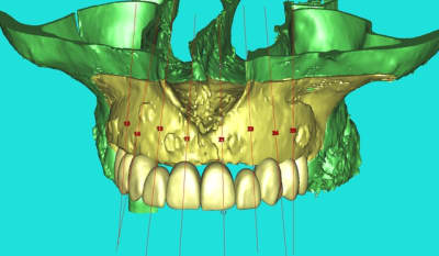 Dar  3dl fwmdk6 - Eugenol