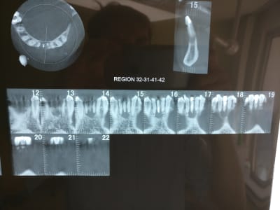Dc2r9eodksxuldsd6yrs - Eugenol