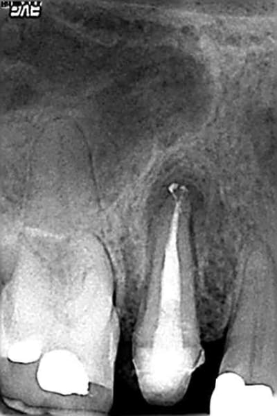 Dec 2010 jwnuej - Eugenol