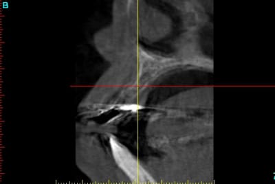 Demcross section122 lm8vkb - Eugenol
