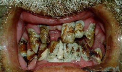 Dents awyaw6 - Eugenol