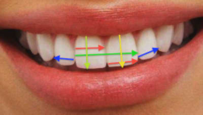 Dents kscy0r - Eugenol