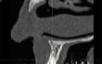 Des le cross section 22 w31w6b - Eugenol