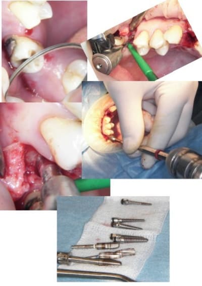 Dia2 jpzdcc - Eugenol