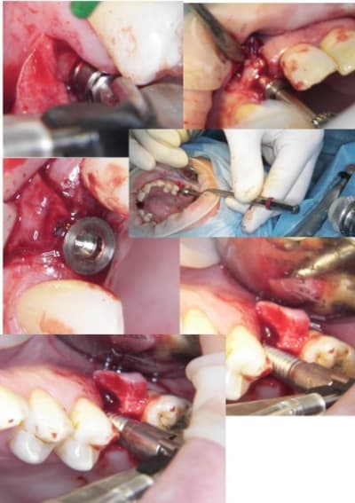 Dia3 ldnimw - Eugenol