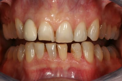 Divers 062 azgkwn - Eugenol