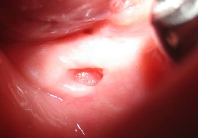 Douleur lr001 we2anf - Eugenol